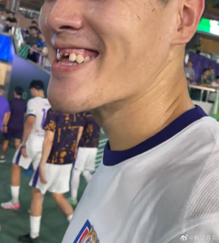 記者：王獻(xiàn)均門牙留在了黃龍?bào)w育中心，很多人一起找都沒找到